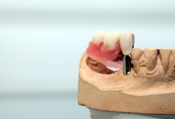 zirconium-porcelain-tooth-plate-in-dentist-store-2023-11-27-05-13-20-utc.jpg